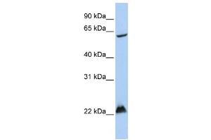 Western Blotting (WB) image for anti-Mahogunin, Ring Finger 1 (MGRN1) antibody (ABIN2458716) (Mahogunin RING Finger Protein 1 antibody)