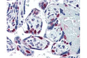Anti-PARP antibody IHC of human placenta. (PARP1 antibody)