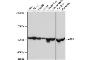 Western blot analysis of extracts of various cell lines, using ATPB Rabbit mAb (ABIN7265722) at 1:1000 dilution. (ATP5B antibody)