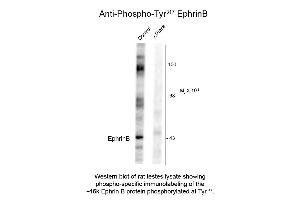Western Blot of Anti-EphrinB pT317 (Rabbit) Antibody - 600-401-D36 Western Blot of Anti-EphrinB pT317 (Rabbit) Antibody. (Ephrin B antibody  (pTyr317))