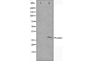 Western blot analysis on COLO205 cell lysate using APAF1 Antibody. (APAF1 antibody  (C-Term))