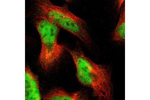 Immunofluorescent staining of U-2 OS with PRKAG2 polyclonal antibody  (Green) shows positivity in nucleus but excluded from the nucleoli. (PRKAG2 antibody)