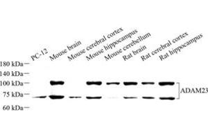Western blot analysis of ADAM23 (ABIN7072942) at dilution of 1: 500 (Adam23 antibody)