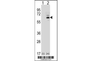 Western blot analysis of FASTK using rabbit polyclonal FASTK Antibody using 293 cell lysates (2 ug/lane) either nontransfected (Lane 1) or transiently transfected (Lane 2) with the FASTK gene.