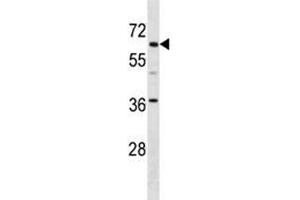 TFE3 antibody western blot analysis in mouse kidney tissue lysate. (TFE3 antibody  (AA 489-516))