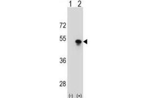 Western Blotting (WB) image for anti-Small Nuclear RNA Activating Complex, Polypeptide 1, 43kDa (SNAPC1) antibody (ABIN2998745) (SNAPC1 antibody)