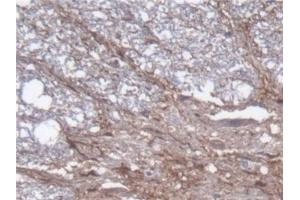 Detection of GFAP in Rat Spinal cord Tissue using Polyclonal Antibody to Glial Fibrillary Acidic Protein (GFAP) (GFAP antibody  (AA 1-430))