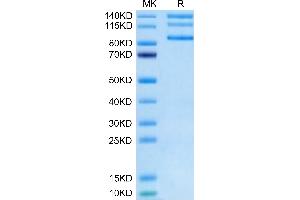 Biotinylated Human Integrin alpha V beta 8 (ITGAV&ITGB8) Heterodimer on Tris-Bis PAGE under reduced condition.