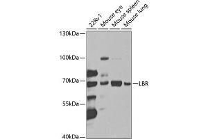 Western blot analysis of extracts of various cell lines, using LBR antibody (ABIN6128194, ABIN6143105, ABIN6143106 and ABIN6221130) at 1:1000 dilution. (Lamin B Receptor antibody  (AA 1-211))