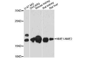 Western blot analysis of extracts of various cell lines, using NME1-NME2 antibody. (NME1-NME2 antibody)