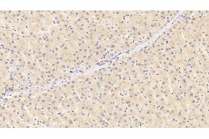 Detection of RBP4 in Human Liver Tissue using Monoclonal Antibody to Retinol Binding Protein 4 (RBP4) (RBP4 antibody  (AA 18-201))