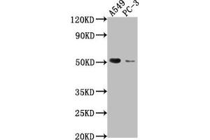 Western Blot Positive WB detected in: A549 whole cell lysate, PC-3 whole cell lysate All lanes: TNFRSF1A antibody at 1:2000 Secondary Goat polyclonal to rabbit IgG at 1/50000 dilution Predicted band size: 51, 39, 26, 25 kDa Observed band size: 51 kDa (TNFRSF1A antibody  (AA 249-455))