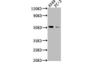 Western Blotting (WB) image for anti-Tumor Necrosis Factor Receptor Superfamily, Member 1A (TNFRSF1A) (AA 249-455) antibody (ABIN7173872)