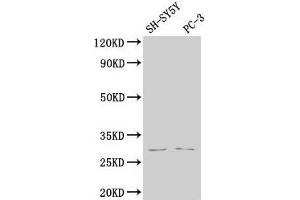 Western Blot Positive WB detected in: SH-SY5Y whole cell lysate, PC-3 whole cell lysate All lanes: APH1B antibody at 1:2000 Secondary Goat polyclonal to rabbit IgG at 1/50000 dilution Predicted band size: 29, 25 kDa Observed band size: 29 kDa (APH1B antibody  (AA 93-110))