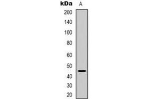 Western blot analysis of ARRDC2 expression in HEK293T (A) whole cell lysates. (ARRDC2 antibody)