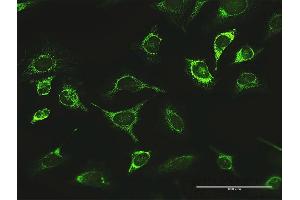 Immunofluorescence (IF) image for anti-Lon Peptidase 1, Mitochondrial (LONP1) (AA 1-959) antibody (ABIN522820)