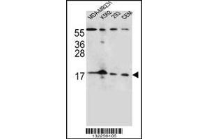 Western blot analysis in MDA-MB231,K562,293,CEM cell line lysates (35ug/lane). (FGF22 antibody  (N-Term))