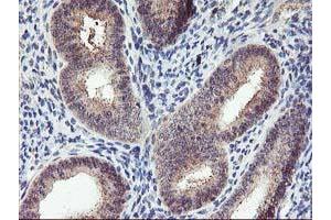 Immunohistochemical staining of paraffin-embedded Human endometrium tissue using anti-PNMT mouse monoclonal antibody. (PNMT antibody)