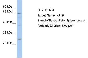 Host: Rabbit Target Name: NAT9 Sample Tissue: Human Fetal Spleen Antibody Dilution: 1ug/ml (NAT9 antibody  (C-Term))