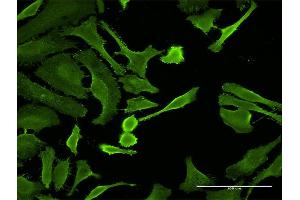 Immunofluorescence of monoclonal antibody to CTLA4 on HeLa cell. (CTLA4 antibody  (AA 36-135))