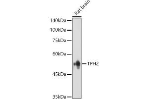 Western blot analysis of extracts of various cell lines, using TET3 antibody (ABIN6133174, ABIN6149021, ABIN6149023 and ABIN6223527) at 1:1000 dilution. (Tryptophan Hydroxylase 2 antibody  (AA 1-170))