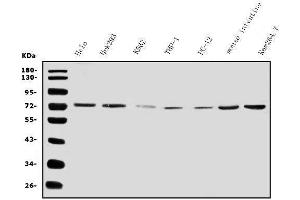 Western blot analysis of IL2 Receptor beta/p75/IL2RB using anti-IL2 Receptor beta/p75/IL2RB antibody (ABIN7600988).