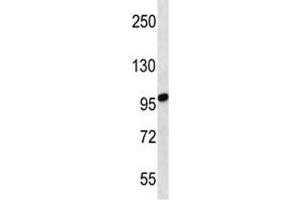 STIM2 antibody western blot analysis in uterus tumor lysate. (Stim2 antibody  (AA 98-127))
