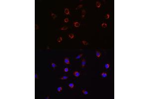 Immunofluorescence analysis of L929 cells using  Rabbit pAb (ABIN6129925, ABIN6136995, ABIN6136996 and ABIN6221112) at dilution of 1:100 (40x lens). (APLP2 antibody  (AA 340-450))