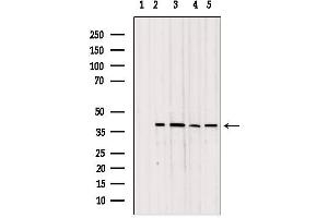 Western blot analysis of extracts from various samples, using TOM40 antibody.