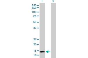 Western Blot analysis of AGTRAP expression in transfected 293T cell line by AGTRAP MaxPab polyclonal antibody. (AGTRAP antibody  (AA 1-152))