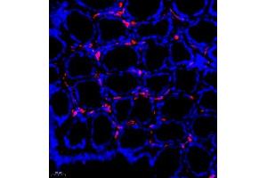 Immunofluorescence of paraffin embedded rat colon using MHC-II (ABIN7074245) at dilution of 1:500 (400x lens) (CD74 antibody)