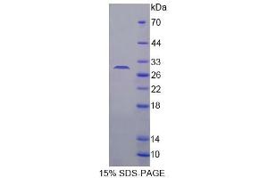 SDS-PAGE analysis of Mouse C/EBP delta Protein. (CEBPD Protein)
