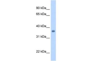 Western Blotting (WB) image for anti-Sarcoglycan, gamma (35kDa Dystrophin-Associated Glycoprotein) (SGCG) antibody (ABIN2462796) (SGCG antibody)