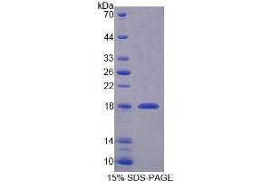 SDS-PAGE (SDS) image for SNAP-Associated Protein (SNAPIN) (AA 2-136) protein (His tag) (ABIN6237539) (SNAPIN Protein (AA 2-136) (His tag))