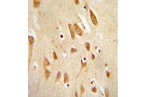 Immunohistochemistry analysis in formalin fixed and paraffin embedded human brain tissue reacted with MAPK8 / JNK1 Antibody (Thr183/Tyr185) followed which was peroxidase conjugated to the secondary antibody and followed by DAB staining.