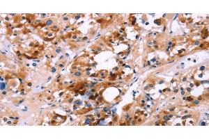 Immunohistochemistry (Paraffin-embedded Sections) (IHC (p)) image for anti-Calbindin (CALB1) antibody (ABIN7236419)