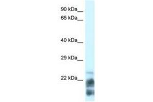 MDP1 antibody  (N-Term)