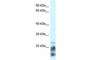 Image no. 1 for anti-Magnesium-Dependent Phosphatase 1 (MDP1) (N-Term) antibody (ABIN6742139) (MDP1 antibody  (N-Term))