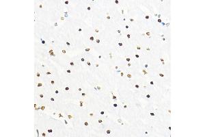 Immunohistochemistry of paraffin-embedded rat brain using ZEB2 Rabbit pAb (ABIN6131480, ABIN6150424, ABIN6150425 and ABIN6221369) at dilution of 1:100 (40x lens). (ZEB2 antibody  (AA 1050-1214))