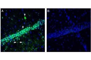 Expression of Neuromedin U Receptor 2 in rat hippocampus. (NMUR2 antibody  (Extracellular, N-Term))