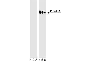 Western blot analysis of TBK1 (pS172) fusion protein. (TBK1 antibody  (pSer172))