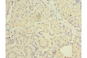 Immunohistochemistry of paraffin-embedded human pancreatic tissue using ABIN7175069 at dilution of 1: 100 (C2orf27A antibody  (AA 3-174))