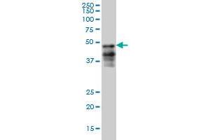 FOXA2 monoclonal antibody (M05), clone 6G9 Western Blot analysis of FOXA2 expression in HepG2 . (FOXA2 antibody  (AA 363-457))