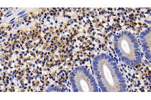 Detection of CASP9 in Human Appendix Tissue using Polyclonal Antibody to Caspase 9 (CASP9) (Caspase 9 antibody  (AA 331-416))