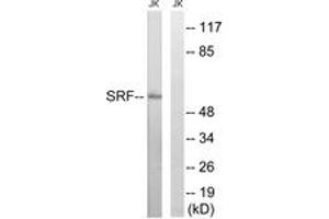 Western blot analysis of extracts from Jurkat cells, treated with insulin 0. (SRF antibody  (AA 41-90))