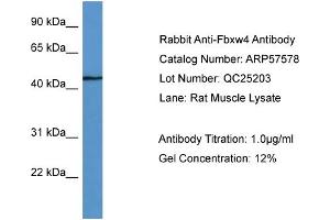 WB Suggested Anti-Fbxw4  Antibody Titration: 0. (FBXW4 antibody  (C-Term))