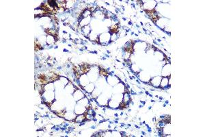 Immunohistochemistry of paraffin-embedded human colon using Peroxiredoxin 3 (PRDX3) (PRDX3) Rabbit mAb (ABIN7269237) at dilution of 1:100 (40x lens). (Peroxiredoxin 3 antibody)