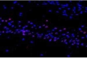 Immunofluorescent analysis of paraformaldehyde-fixed mouse substantia nigra using RMND5A (ABIN7075401) at dilution of 1: 1200