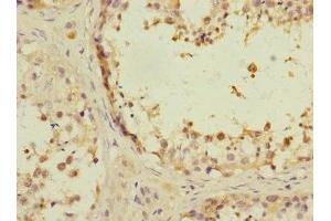 Immunohistochemistry of paraffin-embedded human testis tissue using ABIN7144208 at dilution of 1:100 (ANKS1B antibody  (AA 999-1248))