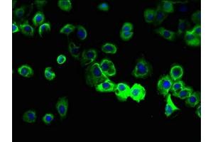 Membrane-Spanning 4-Domains, Subfamily A, Member 8 (MS4A8) (AA 20-74) antibody